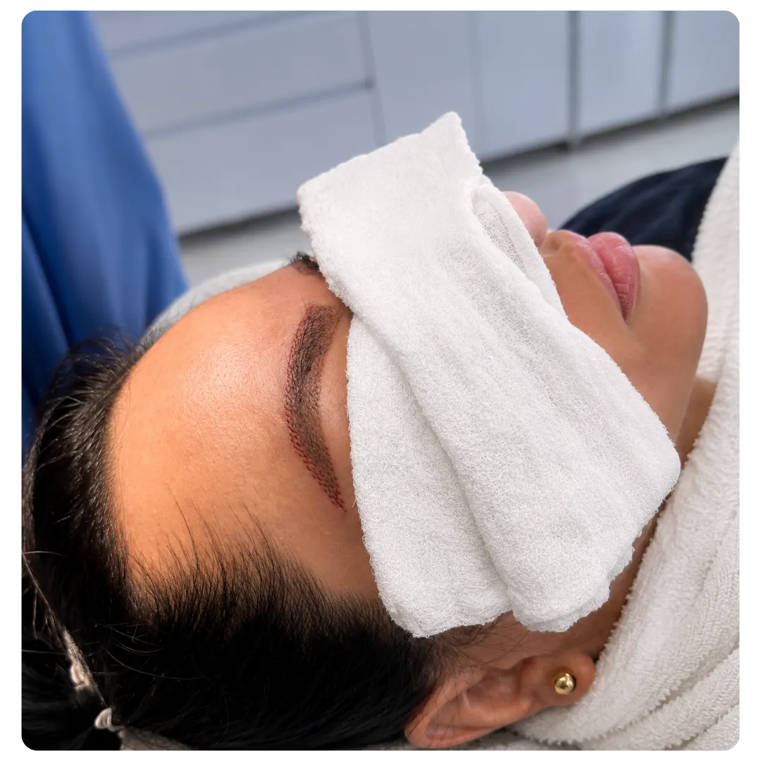 Implante Capilar de Cejas